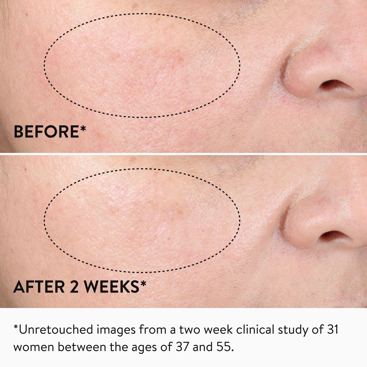 15% Glycolic Acid Overnight Glow Peel